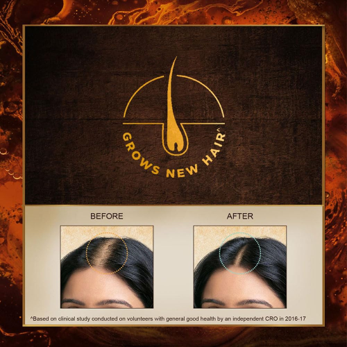 Ayurvedic oil with Bringharaj for reducing hair fall and boosting growth